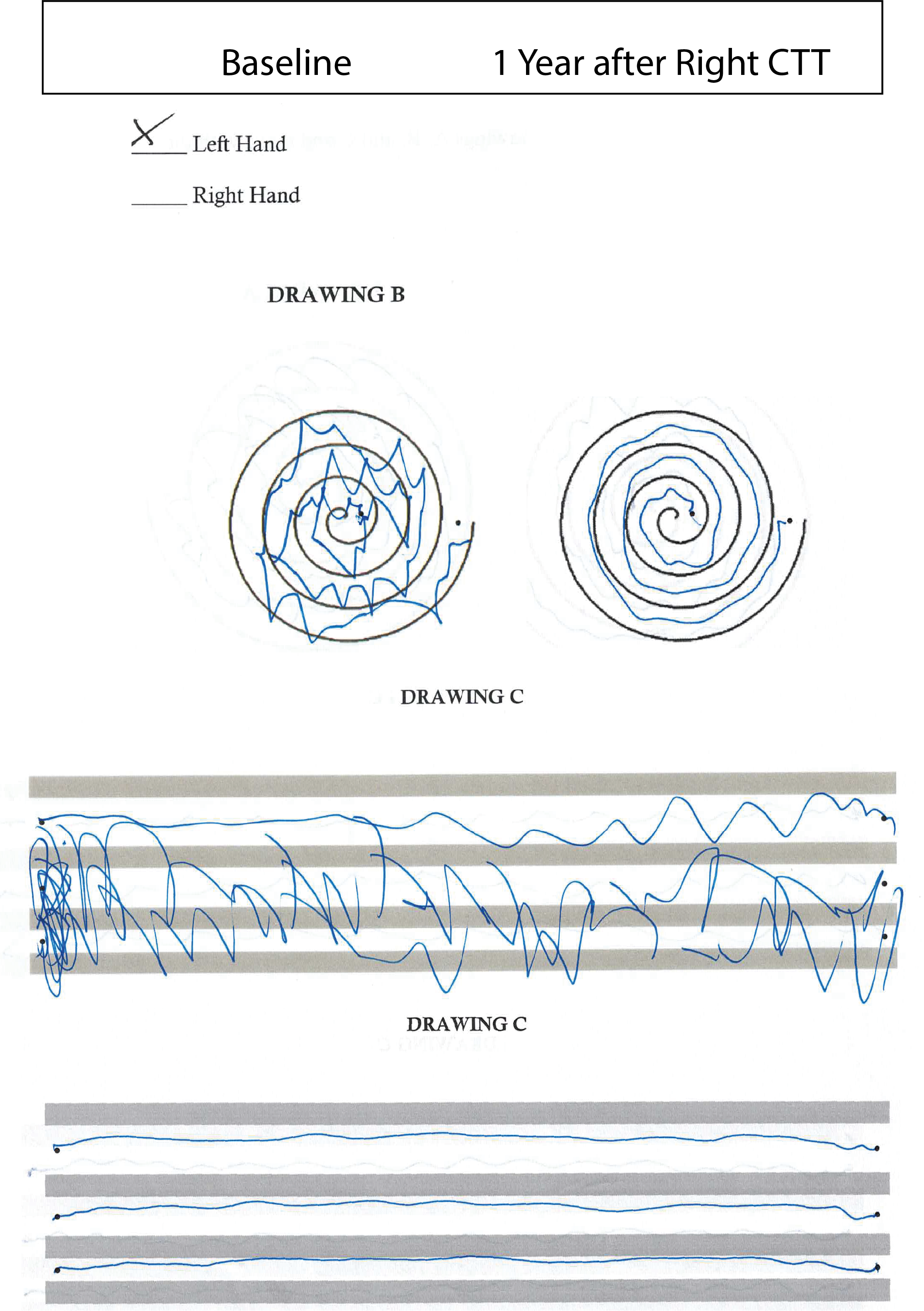 spiral_lines_baseline_1y